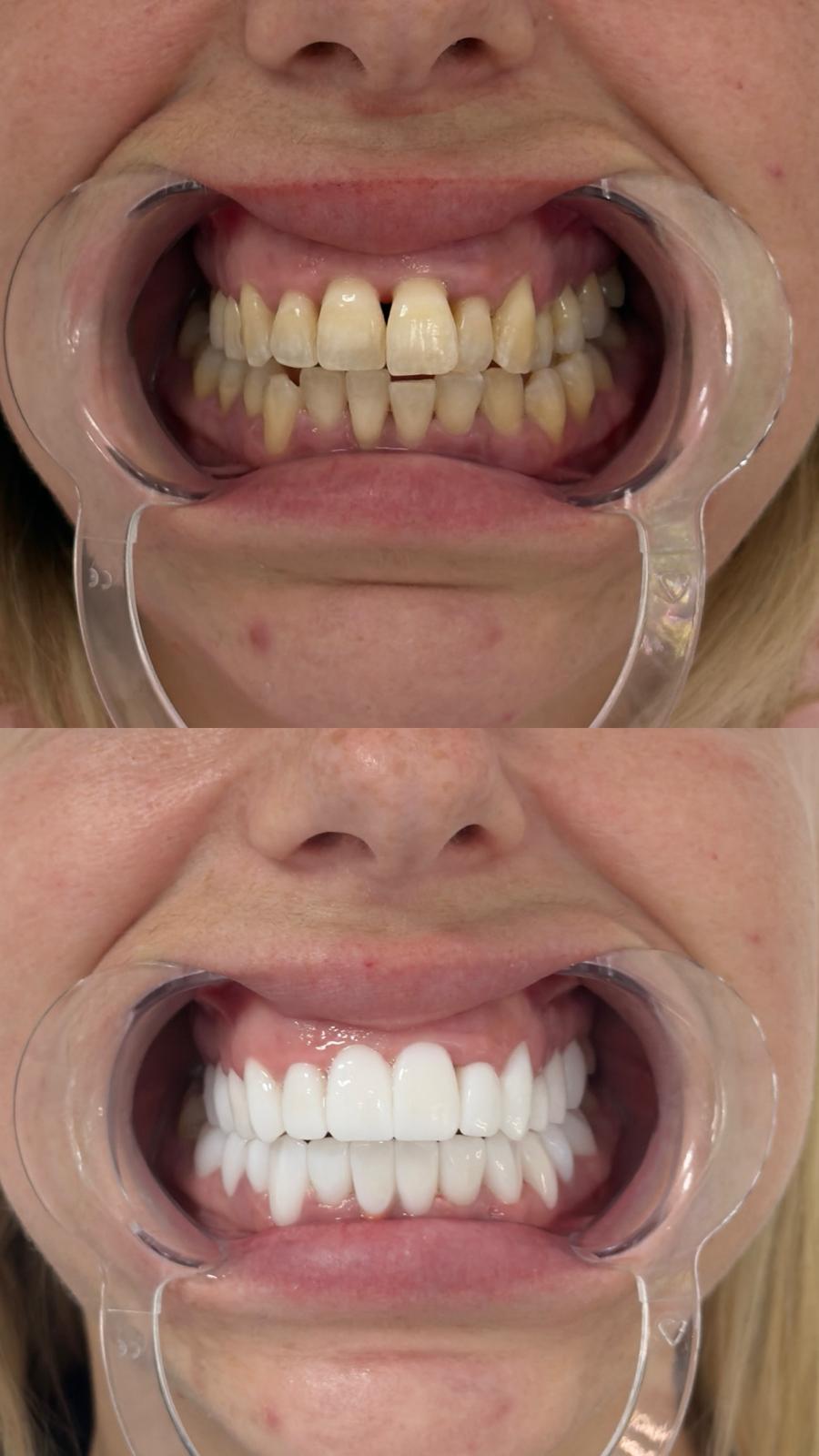 Aesthetic Implants — Gallery image 1